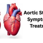 Aortic-Stenosis
