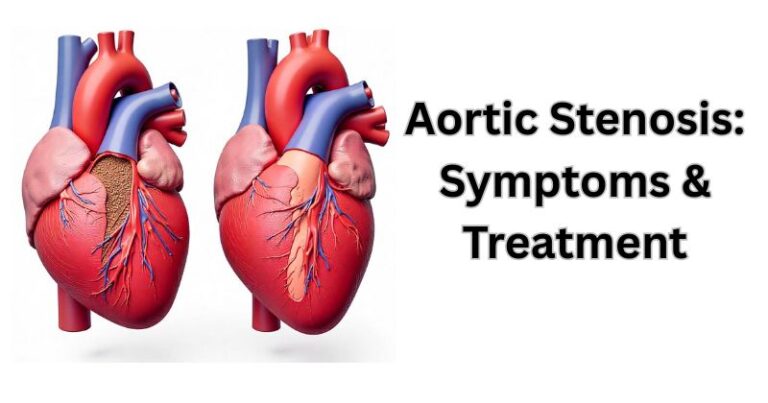 Aortic-Stenosis