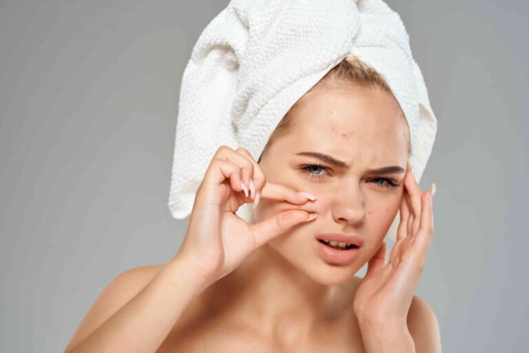 Isotroin 20mg: The Best Treatment for Crestal Acne Breakouts