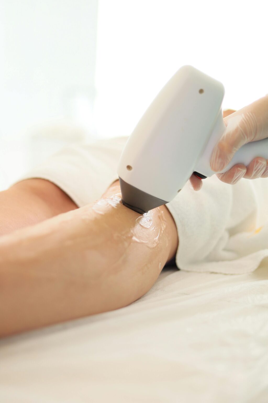 laser hair removal service colleyville