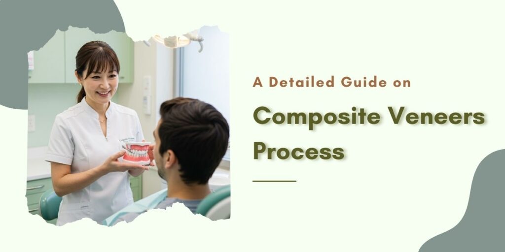 Detailed guide on Composite Veneers by Bayswater Dental Clinic