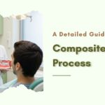 Detailed guide on Composite Veneers by Bayswater Dental Clinic
