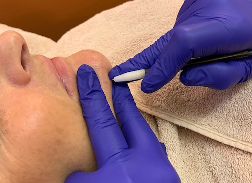 electrolysis