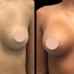 Maximize Your Results: Tips from the Best Aesthetic Clinics in Dubai on Post-Profhilo Care