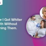 teeth whitening services at london