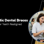 Best orthodontic dental braces provider in London