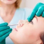 Rhinoplasty in Islamabad