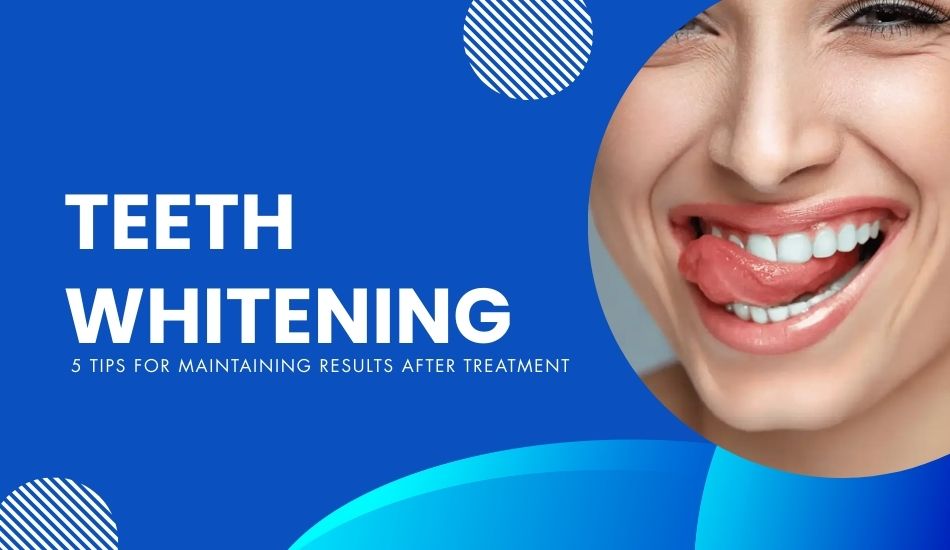 Best teeth whitening treatment results at Bayswater Dental Clinic