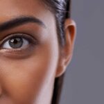 Say Goodbye to Eye Bags: Lower Blepharoplasty in Dubai Explained