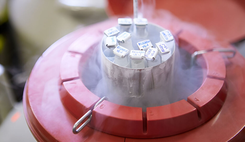 Egg Freezing Treatment