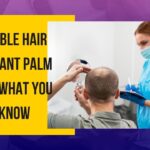 Affordable Hair Transplant Palm Desert: What You Need to Know