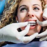 invisalign Havant