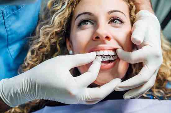 invisalign Havant