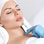 Lip Filler