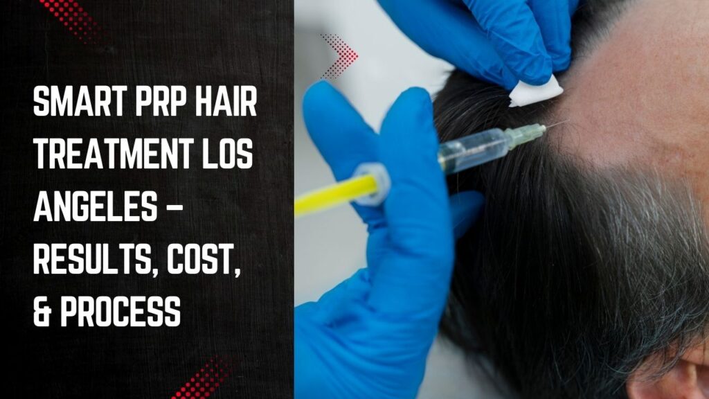 prp hair treatment los angeles