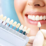 Invisalign Dubai