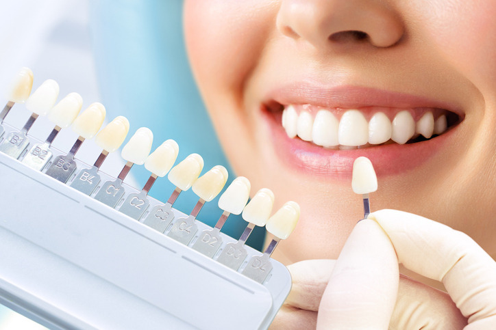 Invisalign Dubai