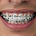 orthodontic treatments