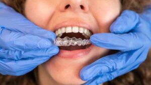 invisalign Havant