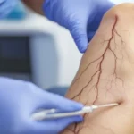 Vein Doctor