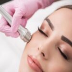 Does mesotherapy work for hair regrowth issues