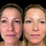 Remove term: Best Aesthetic Clinic in dubai Best Aesthetic Clinic in dubai