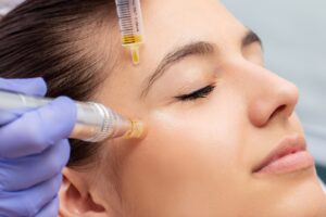 Vampire Facial in Dubai