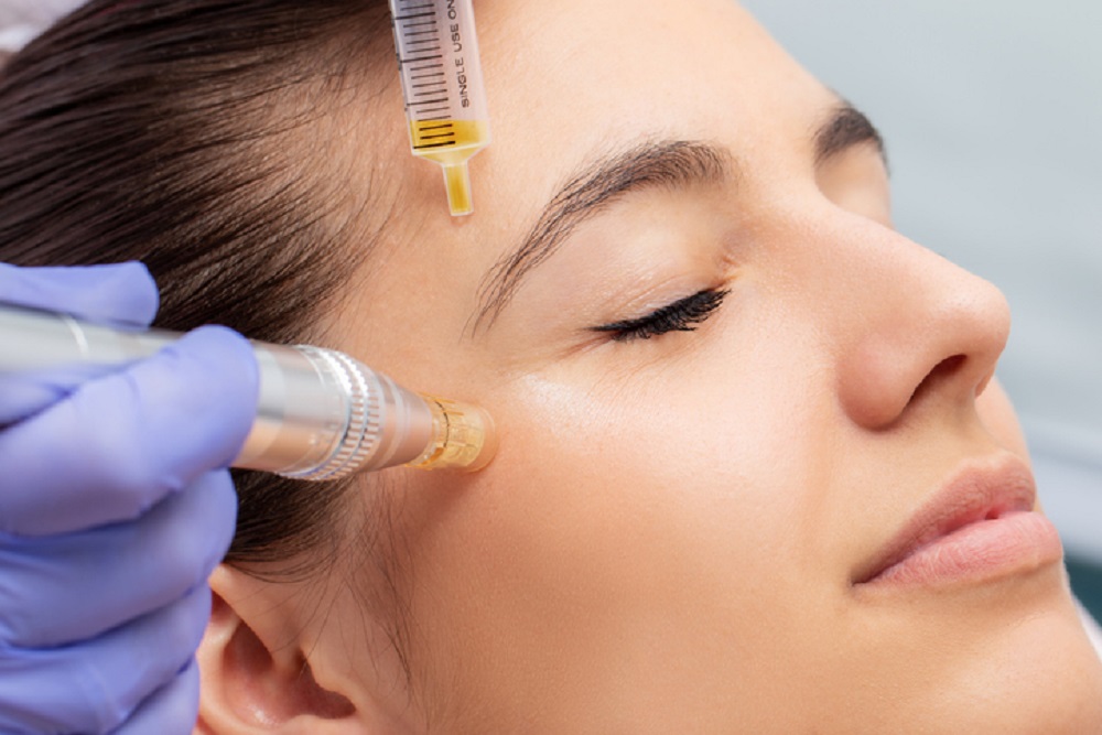 Vampire Facial in Dubai