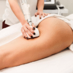 Velashape 3 Treatment in Dubai