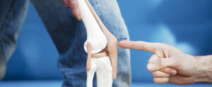 Best Knee Replacement Surgeon in Jaipur