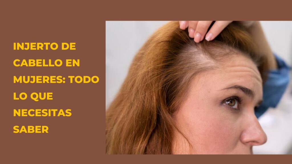injerto de cabello en mujeres