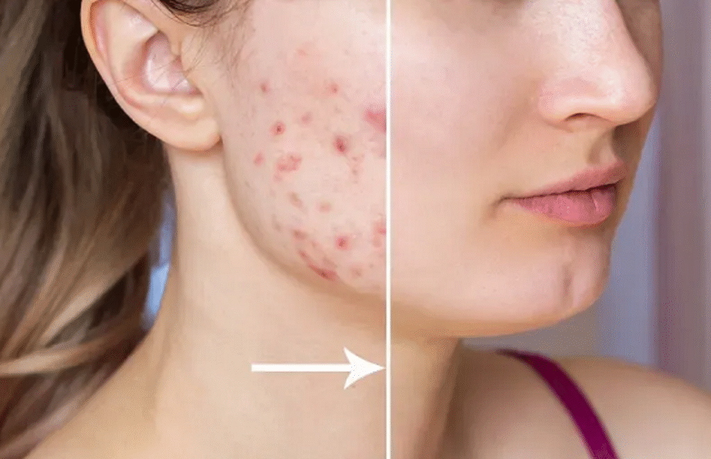 Chemical Peels for a More Youthful Appearance
