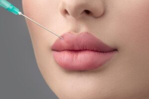 RUSSIAN LI P FILLERS