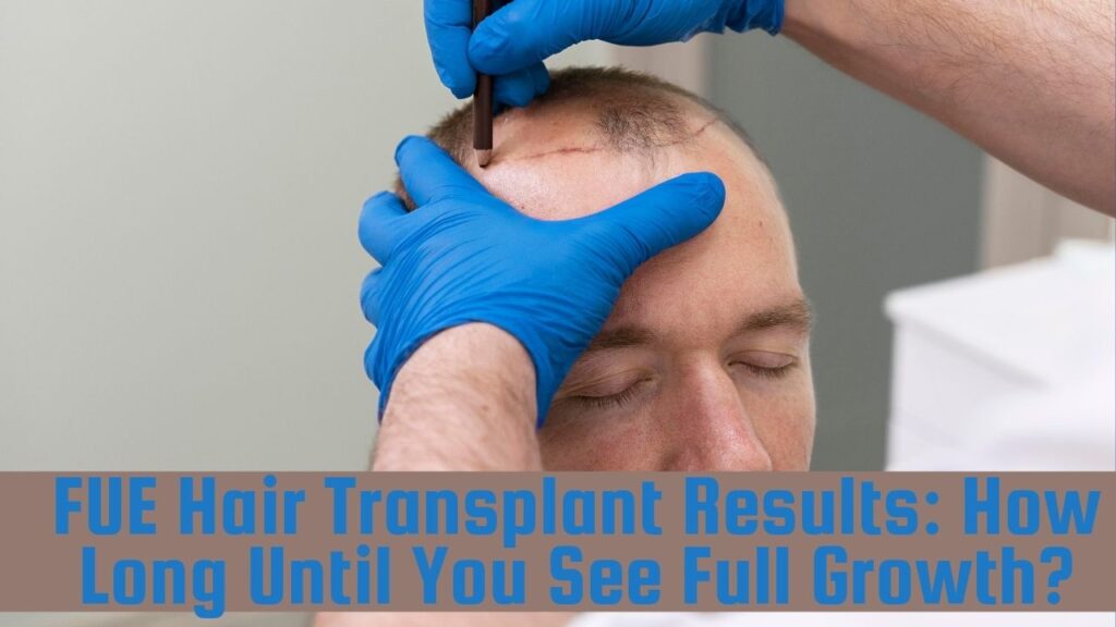 FUE Hair Transplant Results