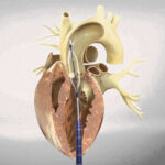 Cardiologist in Jaipur