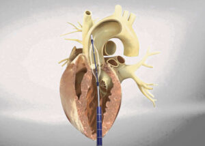 Cardiologist in Jaipur