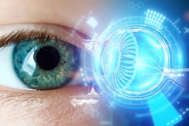 Glaucoma Laser Surgery
