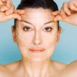 Best Thread Lift in Bangalore: A Simple Way to Lift Without Surgery
