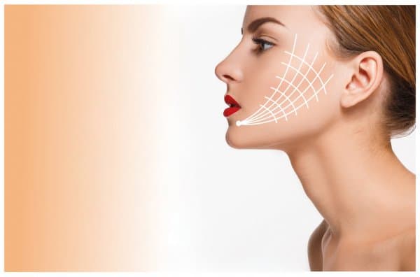 Non-Surgical Skin Tightening with Thread Lift in Dubai