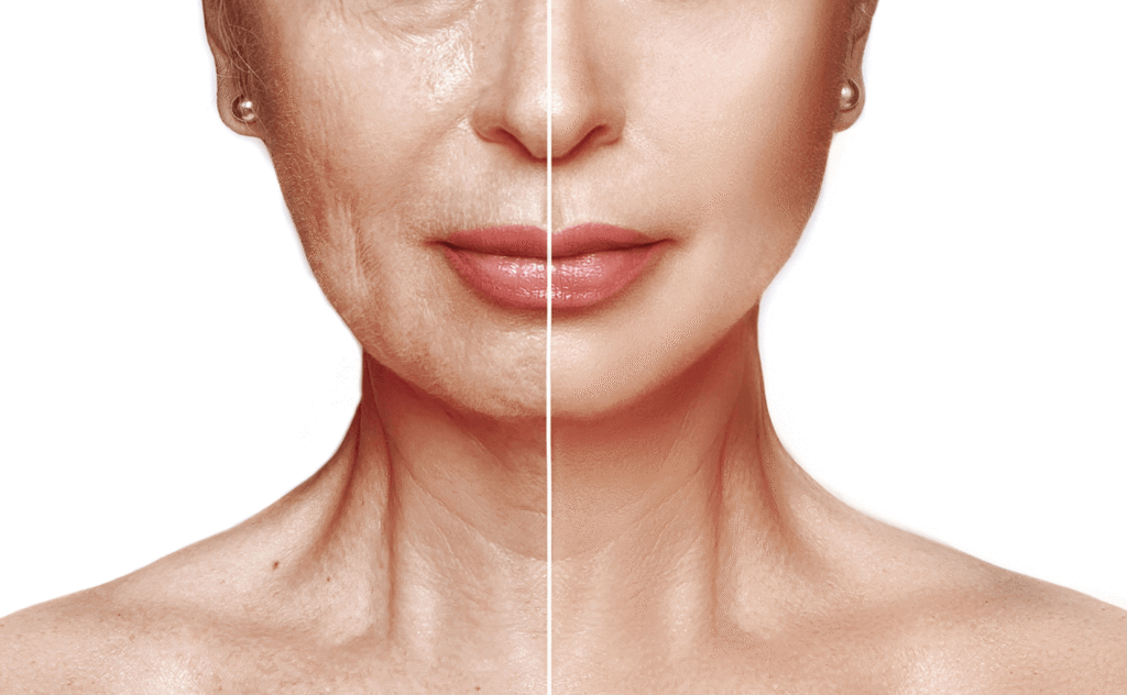 Facelift Surgery: Expert Techniques for Youthful Skin
