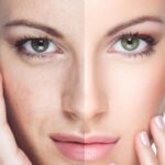 Skin Whitening Solutions Without Damaging Your Skin