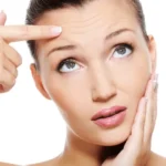 Botox in dubai