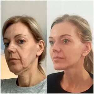 Best Plastic Surgeons in dubai
