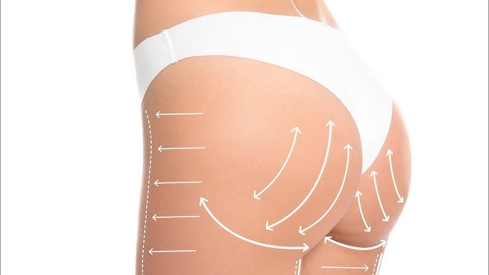 Butt fat transfer in dubai