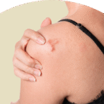 Achieve Natural Looking Skin with Surgical Scar Revision
