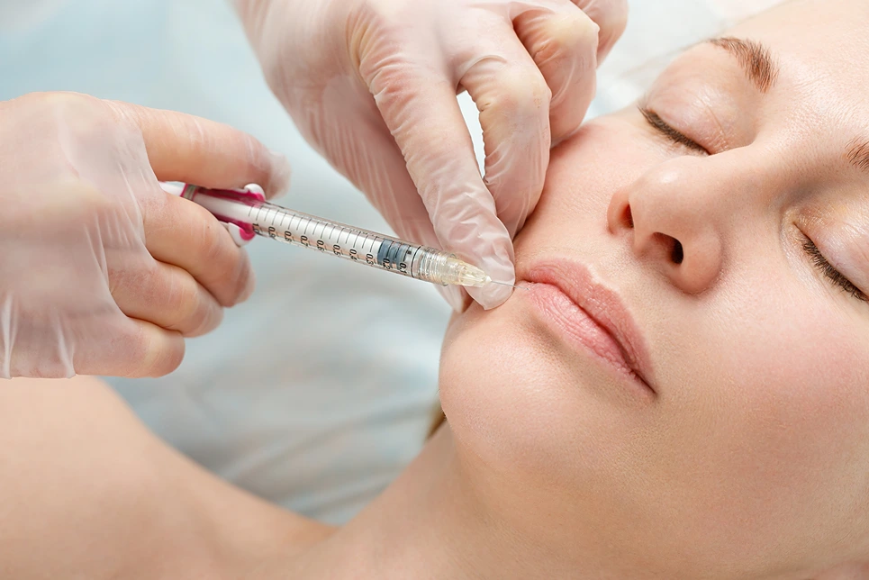 Lip Fillers in Dubai