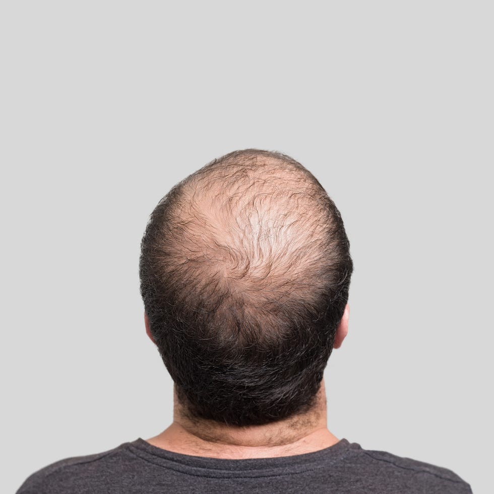 G Cell Hair Treatment in Dubai