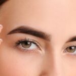Eyebrow Lift Dubai