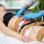 Doctors' Advice on Laser Liposuction in Dubai
