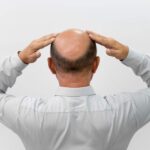Hair Transplant in Dubai